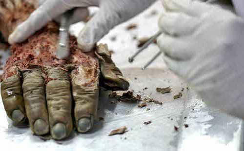 Экскурсия по знаменитым анатомическим музеям мира