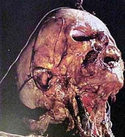 Экскурсия по знаменитым анатомическим музеям мира