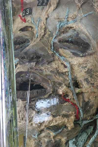 Экскурсия по знаменитым анатомическим музеям мира