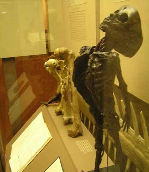 Экскурсия по знаменитым анатомическим музеям мира