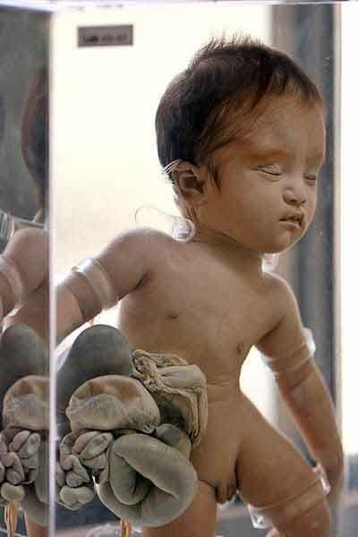 Экскурсия по знаменитым анатомическим музеям мира