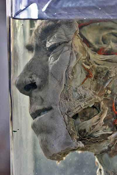 Экскурсия по знаменитым анатомическим музеям мира