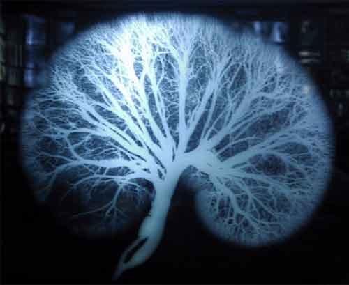 Экскурсия по знаменитым анатомическим музеям мира