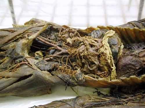 Экскурсия по знаменитым анатомическим музеям мира