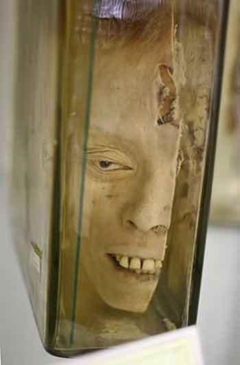 Экскурсия по знаменитым анатомическим музеям мира