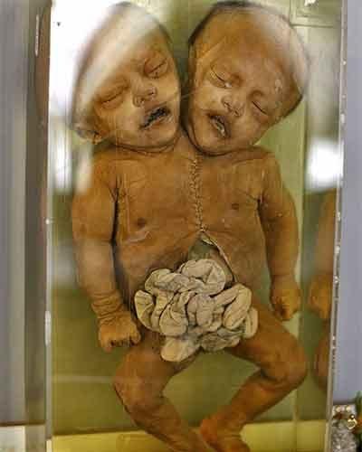 Экскурсия по знаменитым анатомическим музеям мира