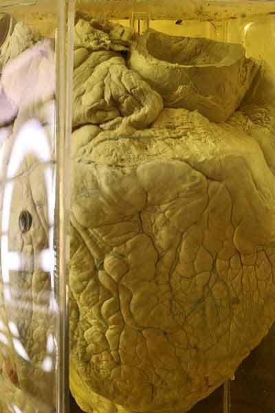 Экскурсия по знаменитым анатомическим музеям мира