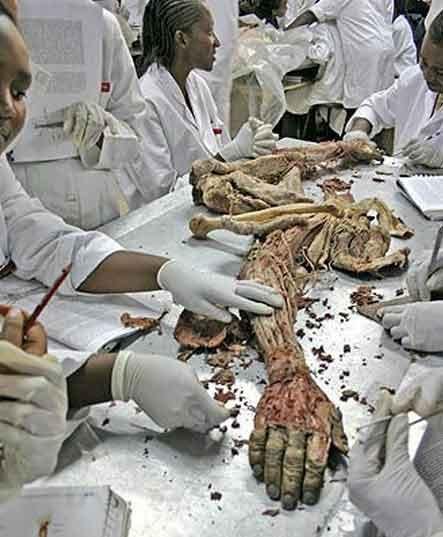 Экскурсия по знаменитым анатомическим музеям мира