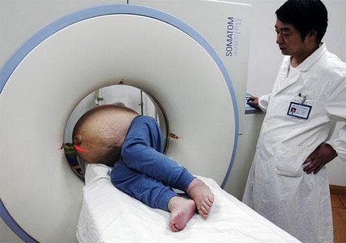 Китаянке отрезали 50-килограммовую опухоль