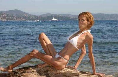 Изабель Каро: модель "с лицом трупа"