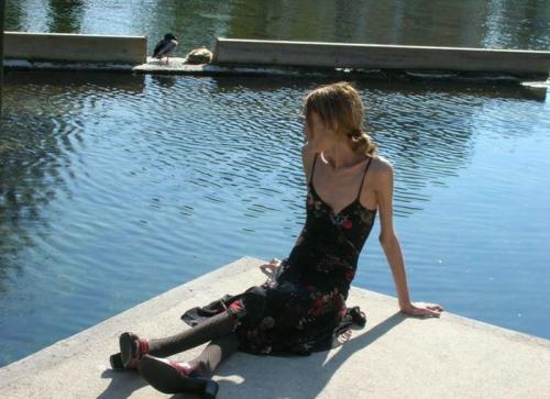 Изабель Каро: модель "с лицом трупа"