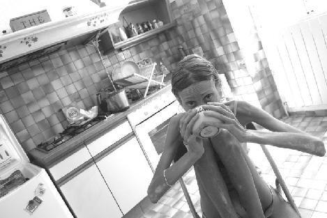 Изабель Каро: модель "с лицом трупа"