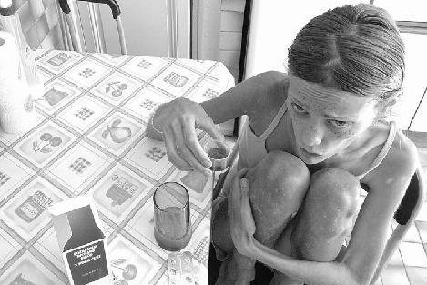 Изабель Каро: модель "с лицом трупа"