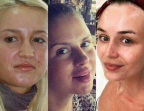 Обман «на лицо»: российские звёзды без макияжа