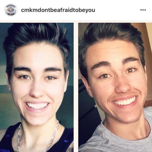 Трансгендеры мира поделились фото своих трансформаций