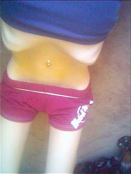 Смерть больных анорексией чаще всего наступает в результате необратимых изменений внутренних органов.