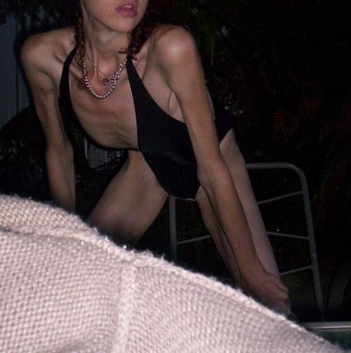 Как следствие - катастрофическое снижение веса, язва желудка, атрофирование мышечной массы, нарушение обмена веществ.