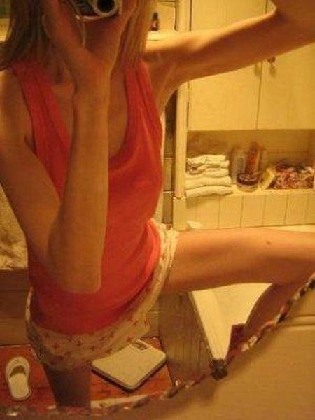 В качестве исходов болезни можно выделить 3 основных направления: выздоровление, рецидив и смерть.