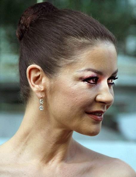 У Кэтрин Зеты-Джонс появились серьезные проблемы с лицом