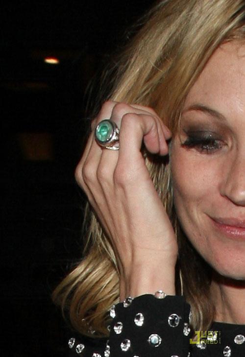 Кейт Мосс растеряла волосы