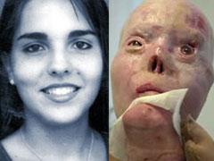 История, потрясшая Америку: жизнь после автокатастрофы