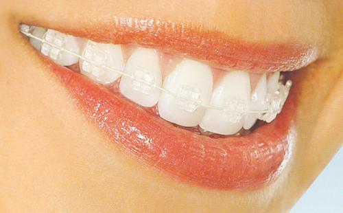 20 изобретений NASA, которые изменили жизнь человека