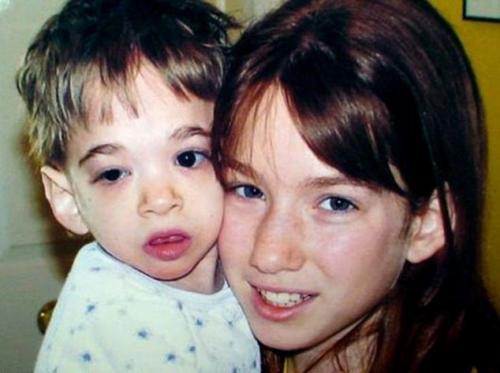 Скончалась 20-летняя Брук Гринбер, запертая в теле ребенка