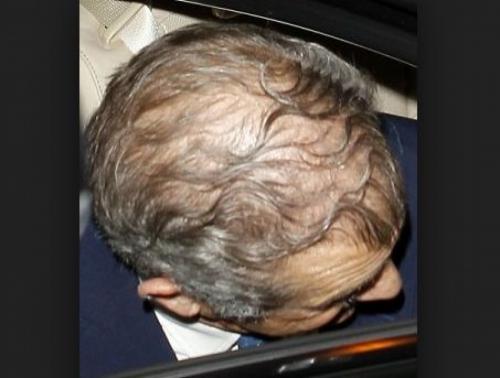 Облысевшие знаменитости, пойманные папарацци без париков