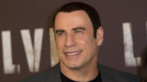 Облысевшие знаменитости, пойманные папарацци без париков