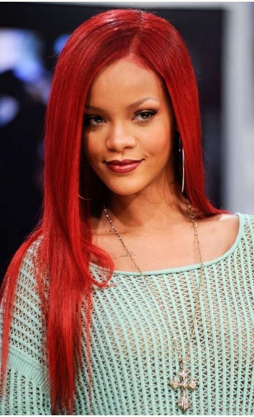 Облысевшие знаменитости, пойманные папарацци без париков