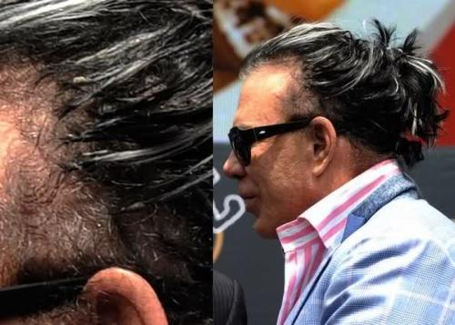 Облысевшие знаменитости, пойманные папарацци без париков