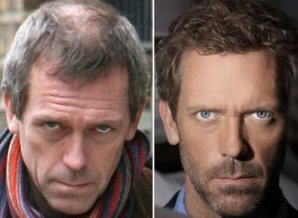 Облысевшие знаменитости, пойманные папарацци без париков