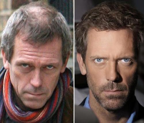 Облысевшие знаменитости, пойманные папарацци без париков