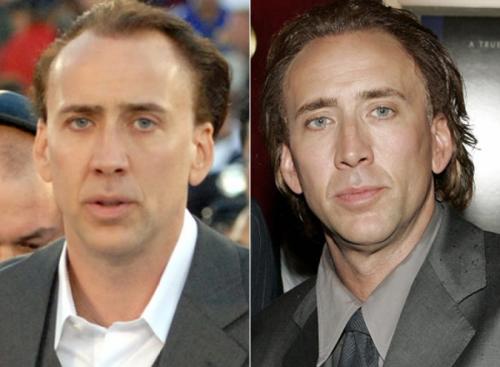 Облысевшие знаменитости, пойманные папарацци без париков