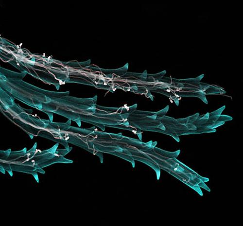 Победители фотоконкурса Wellcome Image Awards 2011