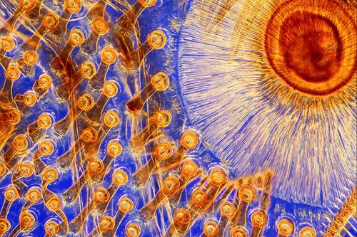 Победители фотоконкурса Wellcome Image Awards 2011