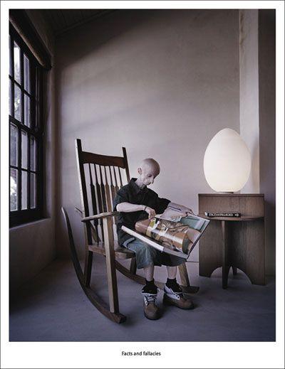 Редкая болезнь художника сделала его похожим на инопланетянина