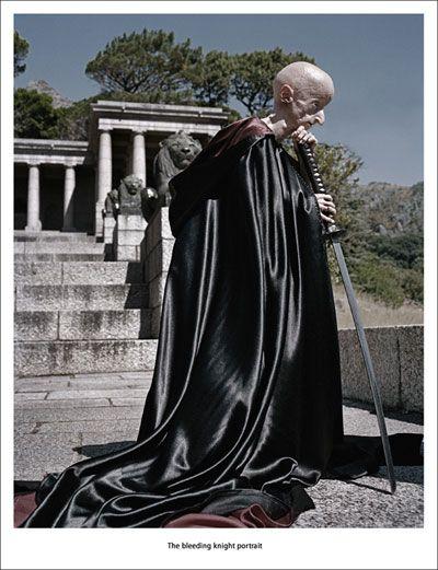 Редкая болезнь художника сделала его похожим на инопланетянина