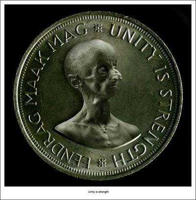 Редкая болезнь художника сделала его похожим на инопланетянина