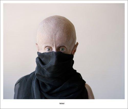 Редкая болезнь художника сделала его похожим на инопланетянина