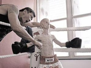 Редкая болезнь художника сделала его похожим на инопланетянина