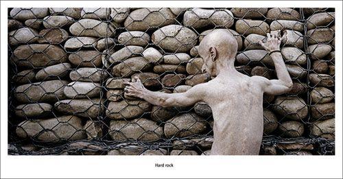 Редкая болезнь художника сделала его похожим на инопланетянина