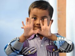 Индийский мальчик с 25-ю пальцами стал знаменитостью
