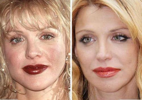 Звёзды ведут борьбу за безупречные носы