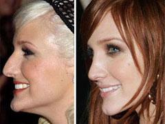 Звёзды ведут борьбу за безупречные носы