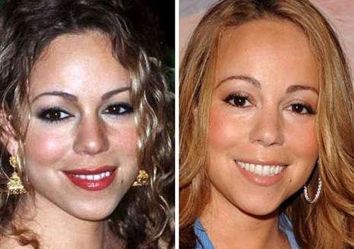 Звёзды ведут борьбу за безупречные носы