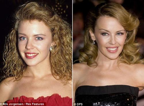 Звёзды помолодели на 20 лет