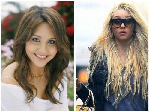 Известные актеры, страдавшие психическими расстройствами