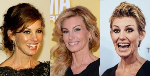 Знаменитости, которым брекеты кардинально сменили улыбку