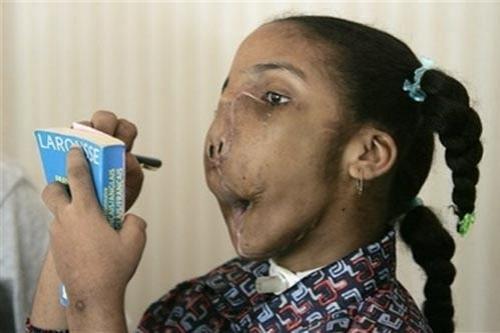 Самые гигантские опухоли на теле человека